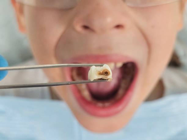 Best Pediatric Emergency Dentist in Lakewood, CA